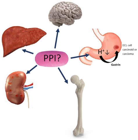 Proton pump inhibitors in chronic liver disease: accomplice or bystander?