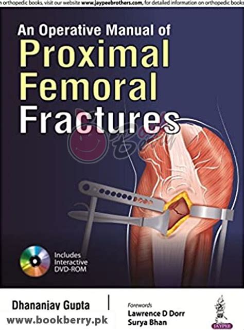 Proximal femoral fractures an operative manual. - El manual de investigación de accidentes de tráfico de james stannard baker.