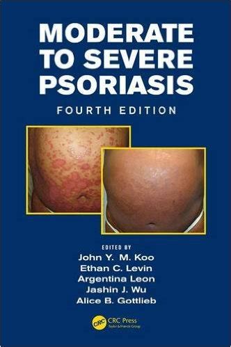 Psoriasis a patients guide fourth edition. - California law exam for physical therapy study guide.