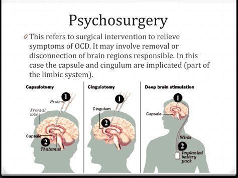 Psychosurgery; present indications and future prospects