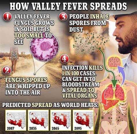 Public warned of rise in Valley fever infections across Southern California
