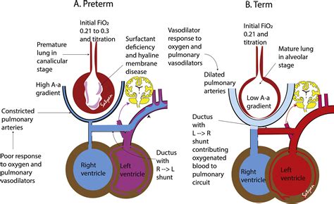 Pulmonary Hypertension in Extremely Preterm Infants (PiEP)