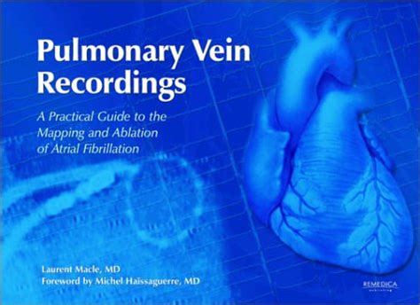Pulmonary vein recordings a practical guide to the mapping and ablation of atrial fibrillation 2nd e. - Lg hb905ta dvd home theater system service manual.