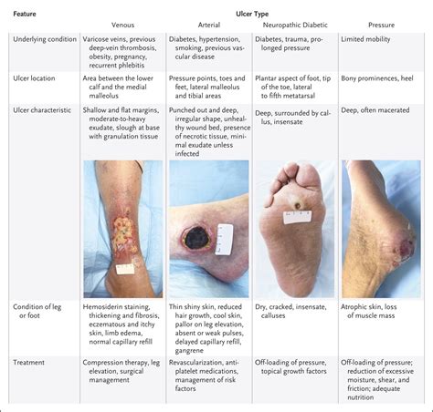 26 jun 2023 ... Puncture wounds occur more than 50% of the time on the plantar surface of ... Lipsky et al developed a 10-item diabetic foot infection wound .... 