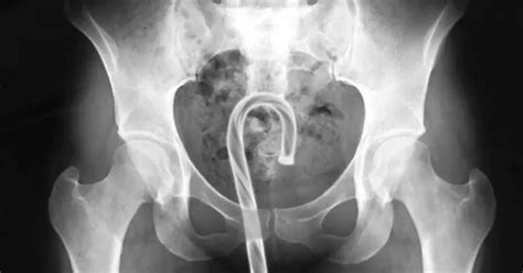 Pussy with unusual objects.  29,298 Bizarre objects pussy insertion FRE...