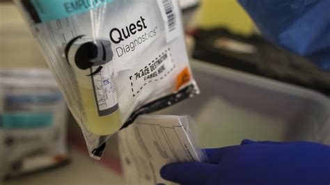 Find 122 listings related to Quest Diagnostics 
