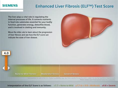 Quest liver fibrosis panel.  Get know how much does lab test cost.  The Enhanced L...