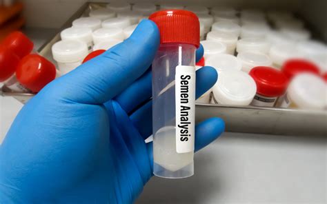 A semen analysis is a male fertility test that measures the quality and quantity (amount) of sperm present in the semen, which is the fluid released during a man’s ejaculation. Semen analysis, also known as a sperm count test, requires a semen sample. There are two common ways a man can collect and provide a sample: masturbating into a .... 