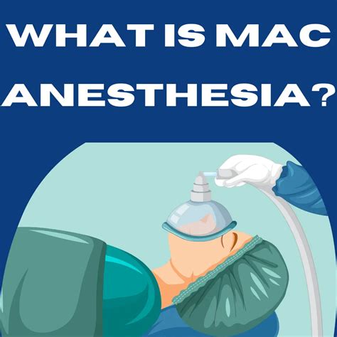 Question: What is used in Mac sedation? - De Kooktips