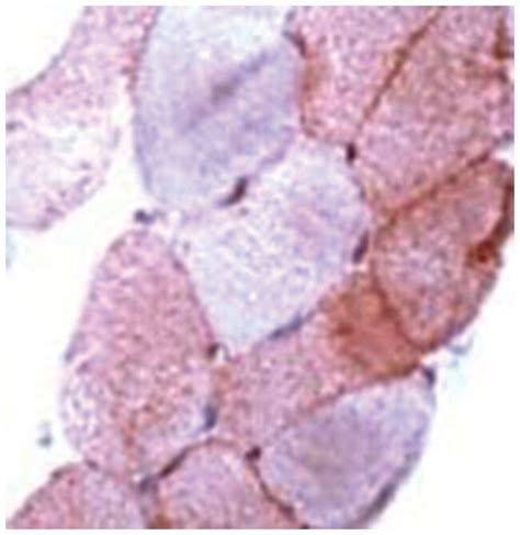 RBX1, Rabbit anti-Human, Polyclonal Antibody, Abnova™