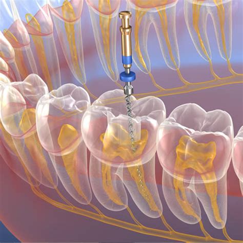 RED HOUSE Dental - Overview, News & Competitors - ZoomInfo