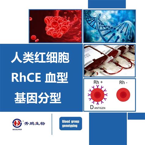 RHCE Testengine