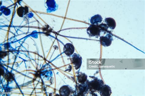 Rhizopus oligosporus - ScienceDirect - muktibox.com