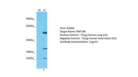 RND1 Antibody - C-terminal region (ARP61632_P050)