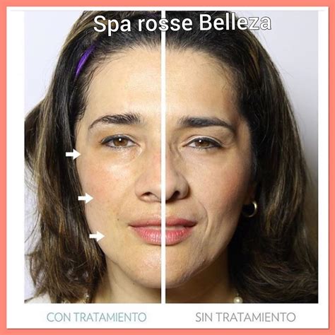 ROSSE SPA & BEAUTY (@aydinrossespa09) Instagram.