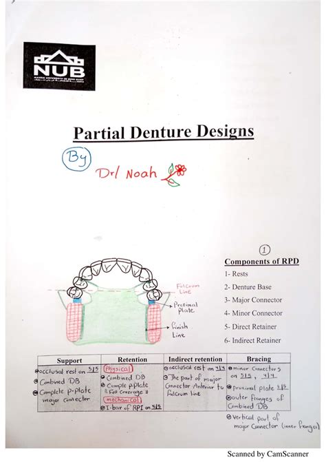 RPD Design by Noah