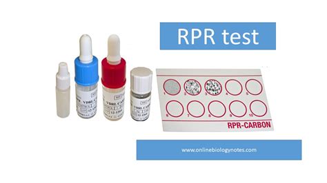 RPR test Principle, Procedure, Result interpretation and Application