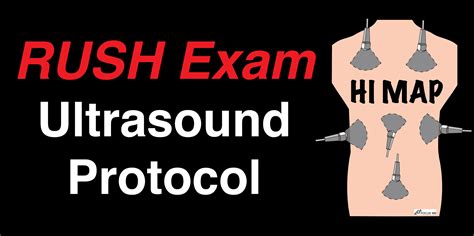 RUSH Exam Ultrasound Protocol: Step-By-Step Guide