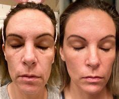 Rachel river facelift wand. Check rachelriver.com with our free review tool and find out if rachelriver.com is legit and reliable. Need advice? Report scams Check Scamadviser! 