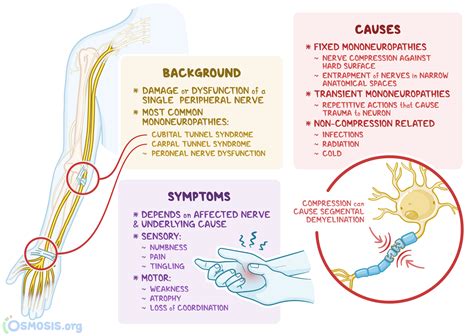 Radial Nerve Mononeuropathy PM&R KnowledgeNow