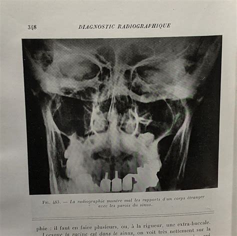 Radiographie bucco dentaire et agents physiques en stomatologie. - 610 bobcat repair manual free download.