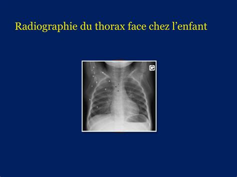 Radiographie chez l