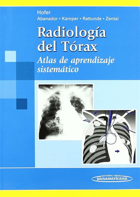 Radiologia del torax atlas de aprendizaje sistematico spanish edition. - Crappie wisdom an in fisherman handbook of strategies.