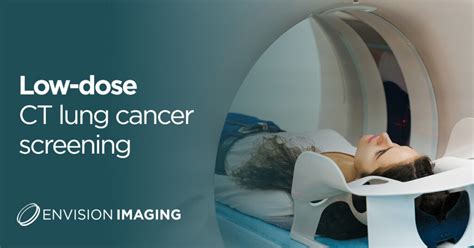 Radiologic Data Reporting System Lung Cancer Screening LowDose CT