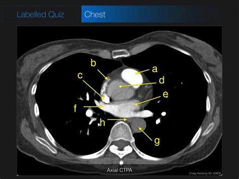 Radiology Quiz 45647 Radiopaedia.org