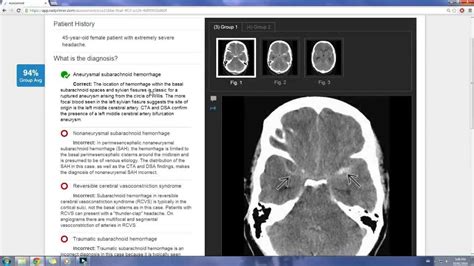 Radprimer. RADPrimer is a comprehensive online platform for radiology training and education, covering core radiology disciplines and topics. Physicians can customize their … 