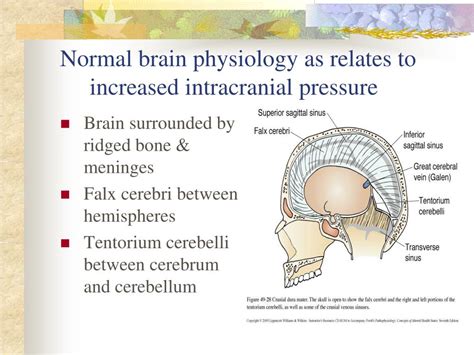 Raised intracranial pressure and brain edema - PubMed