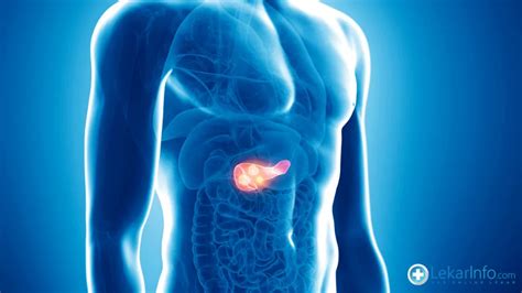 Rak pankreas.  To čini te&scaron;kim da se bolest pravilno prepozna.  3 days ago · Va&scaron; ...