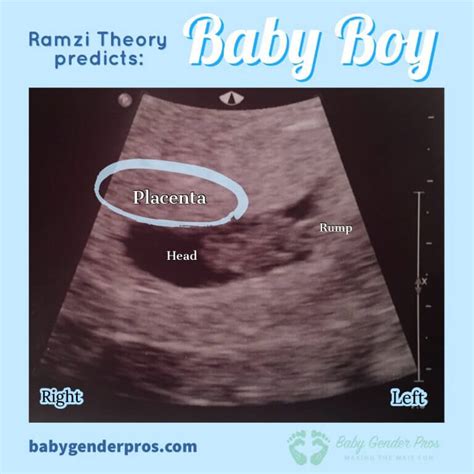 According to the Ramzi Theory, boy babies have the placenta fixed on the right side. This means that if the picture shows the placenta on the left, in reality, it is on the right, due to being a mirror image. And in the Ramzi Theory, girl babies will be placed on the left side. So, in the mirror image, the placenta will show on the right.. 