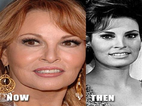 Raquel Welch has grabbed wide attention since 1960s. There were many things that popularized her name. From fur bikini to big hair to sex icon status, Welch has been blessed with power to influence the world. But she is getting older and the situation has much changed. It is time for her to get influenced by culture near her. Specifically speaking, she couldn't resist the cosmetic surgery .... 