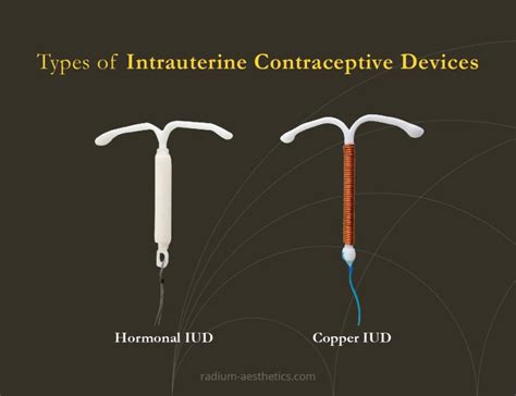 Reactive Cellular Changes, Intrauterine Contraceptive Device