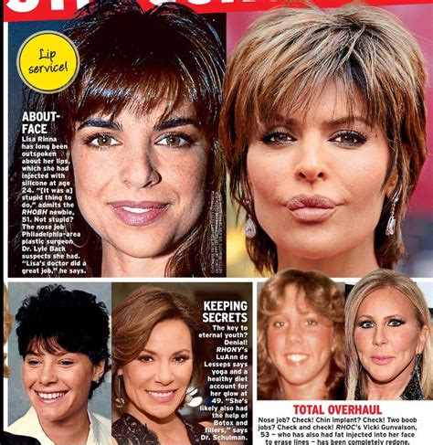 Real Housewives Of New York: All The Plastic Surgery The Cast …