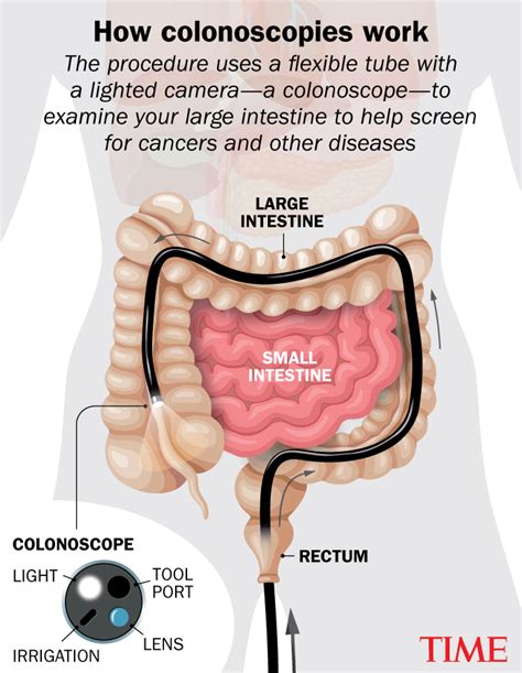 Real colonoscopy porn pictures. 2k2.  Concerns About Modesty During Colonoscopy What is Col...