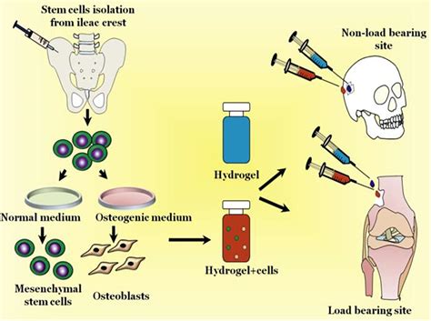 Recent Advances of Chitosan-Based Injectable Hydrogels for Bone …