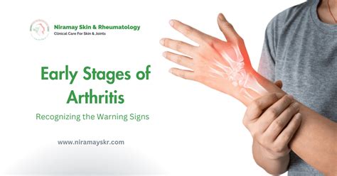 Recognizing the First Signs of Arthritis An Informative Guide