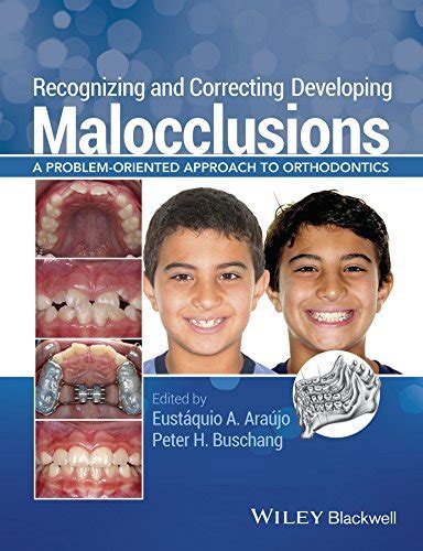 Read Recognizing And Correcting Developing Malocclusions A Problemoriented Approach To Orthodontics By Eustquio A Arajo