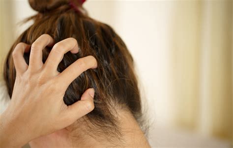 RecognizingSymptomsofScalpSensitivity
