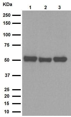 Recombinant Anti-Fyn antibody [EPR5500] (ab125016)