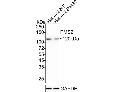 Recombinant Rabbit Anti-Human PMS2 Monoclonal Antibody, …