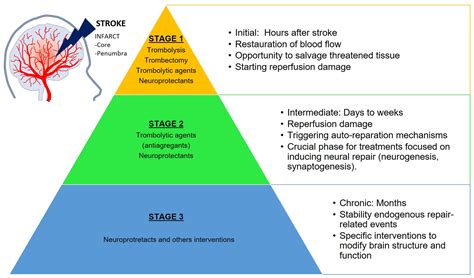 Reconfiguring stroke care The King