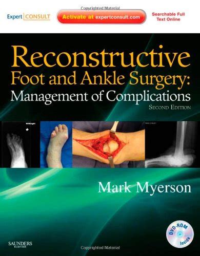 Read Reconstructive Foot And Ankle Surgery Management Of Complications By Mark S Myerson