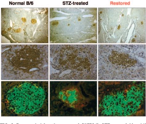 Recovery of Islet β-Cell Function in Streptozotocin- Induced Diabetic ...