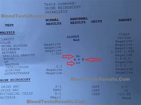 Red Flags H, L, A, C, Astric, Stars, Arrows on results, what is meanin…