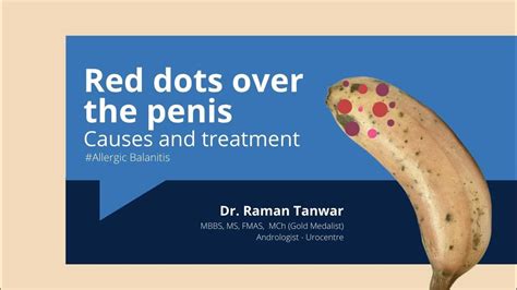 Red Spots on Penis, Dots, Bumps, Itch, Pictures, Get Rid, Treatment