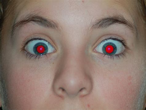 Red Eye Remover is a program that can remove a common "red-eye" effect from your images in an almost automatic mode. Just select a rectangular area around the eye and our program will ...