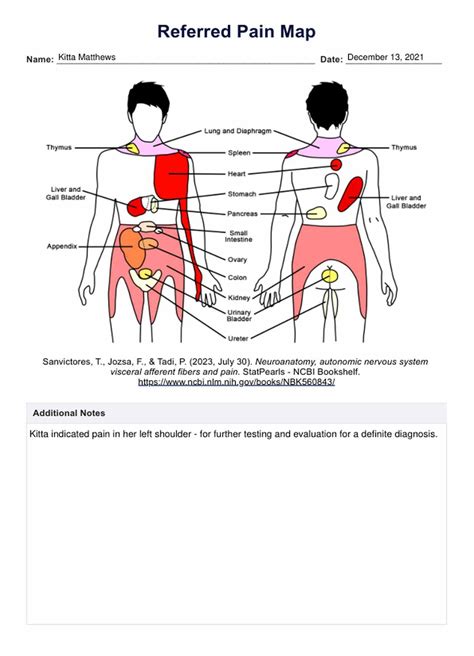 Referred Pain Chart Back
